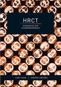 HRCT : diagnostik och sjukdomsöversikt